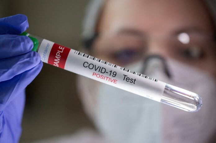 FILE PHOTO: A test tube labelled